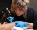 Can laser treatment remove tattoos